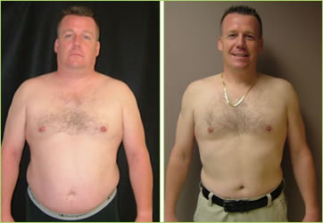 Daniel: 50 lb. Weight Loss - Dr. Kerendian patient review and weight loss  results testimonial