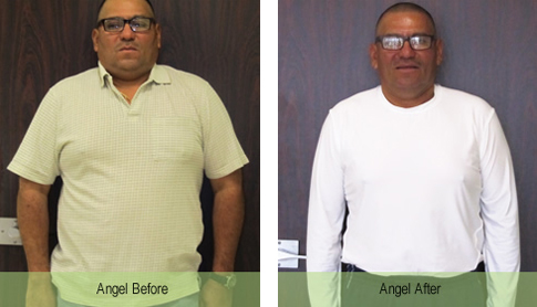 Angel: 50 pound weight loss