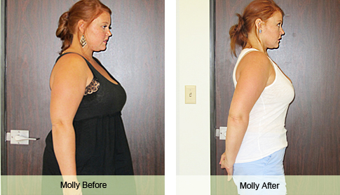 Molly Weight Loss Success