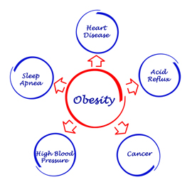 Obesity as a Disease