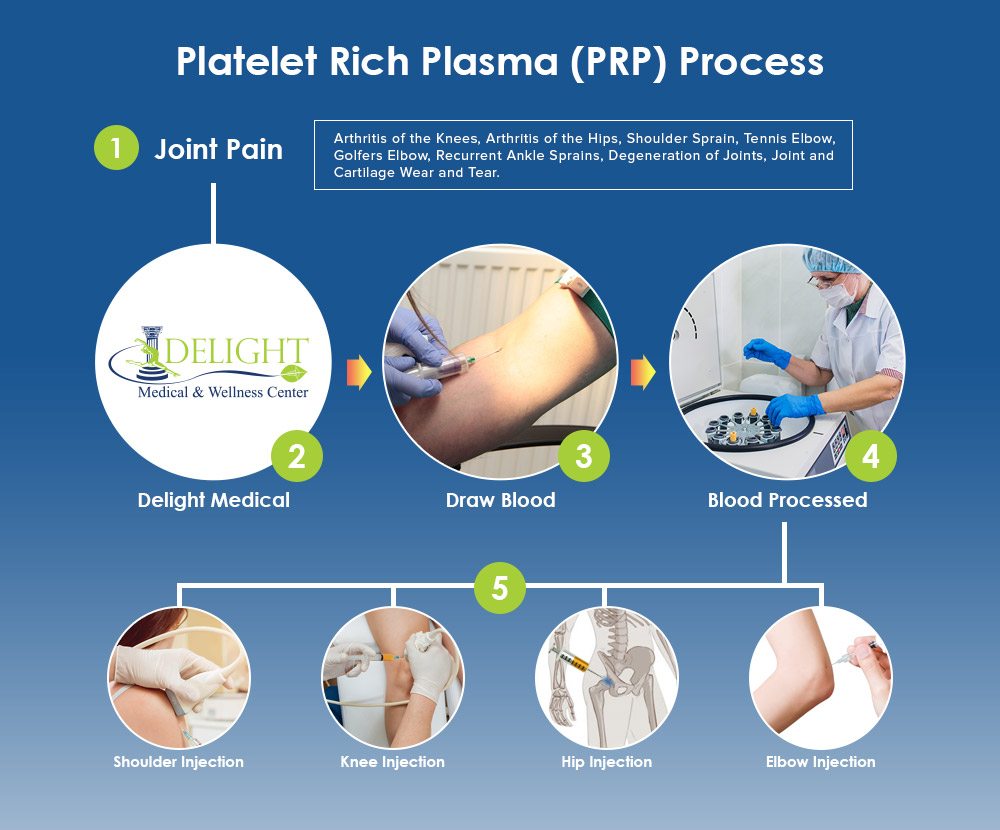 PRP Process