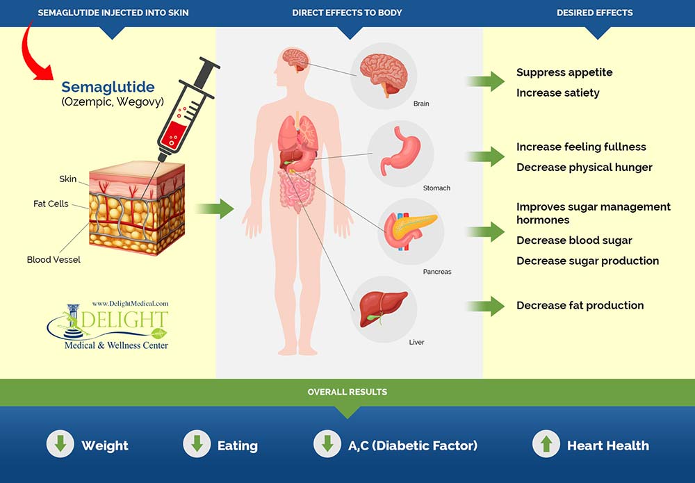 Semaglutide (Wegovy or Ozempic) process